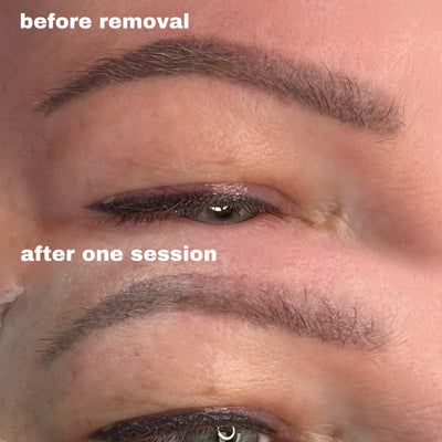 Rejuvi Tattoo Removal Training (IN-PERSON) - Light Touch Permanent Makeup Studio & Trainings