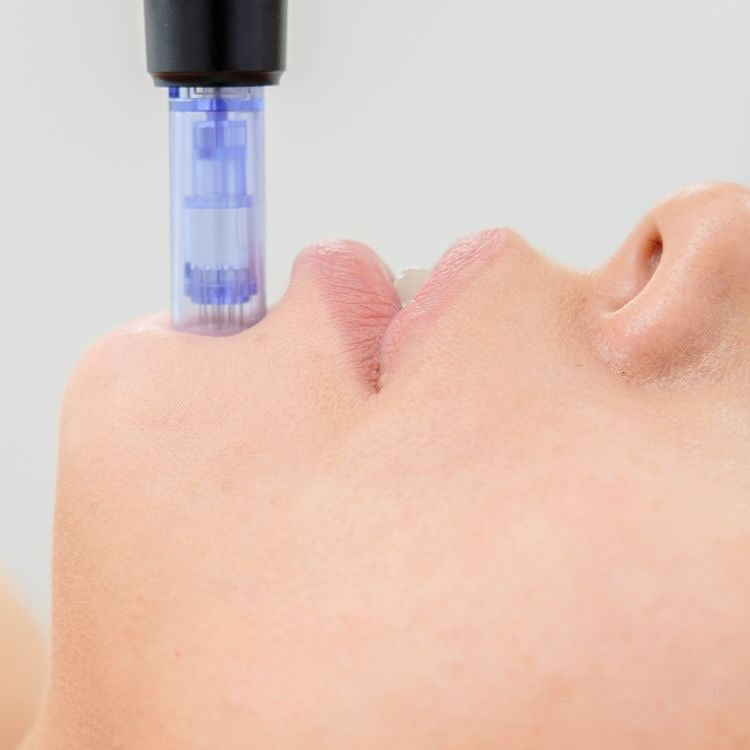 Microneedling Training (IN-PERSON)
