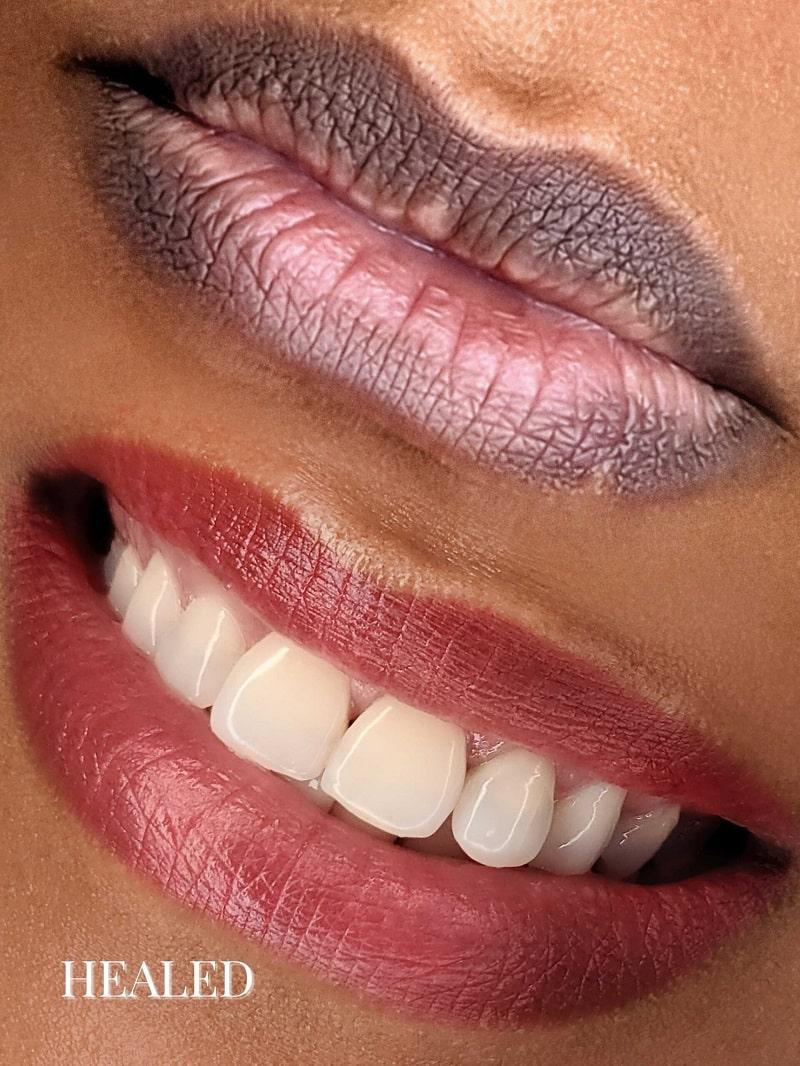 Dark Lips Correction Training (IN-PERSON) - Light Touch Permanent Makeup Studio & Trainings