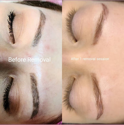 Rejuvi Tattoo Removal Training (IN-PERSON) - Light Touch Permanent Makeup Studio & Trainings